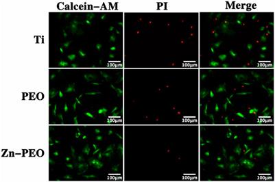 Fabrication, properties and biological activity of a titanium surface modified with zinc via plasma electrolytic oxidation